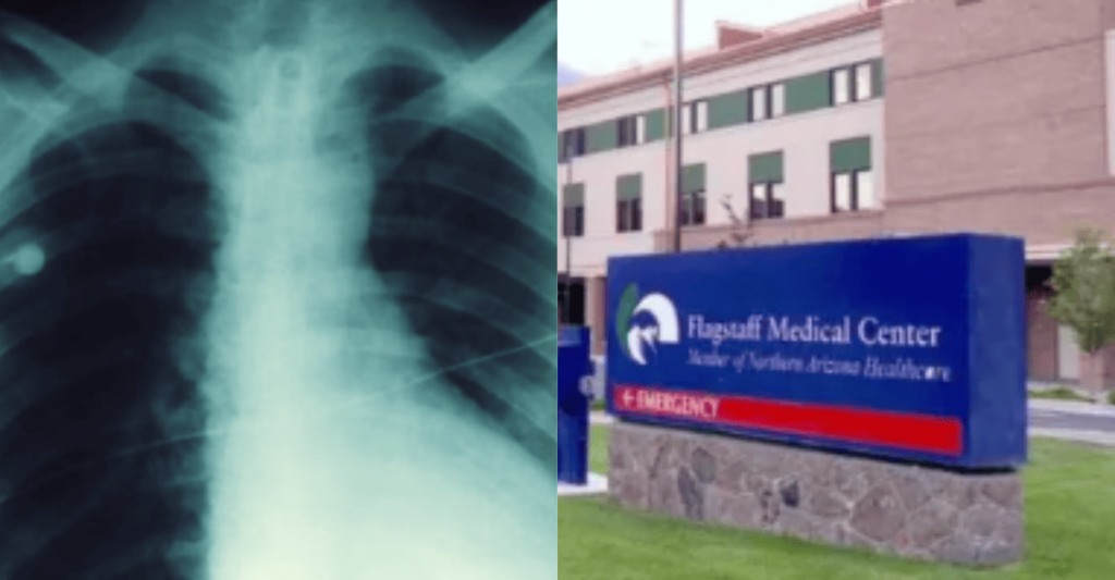 Plague Kills Patient in Arizona Hospital ER—First U.S. Death Since 2021 ...